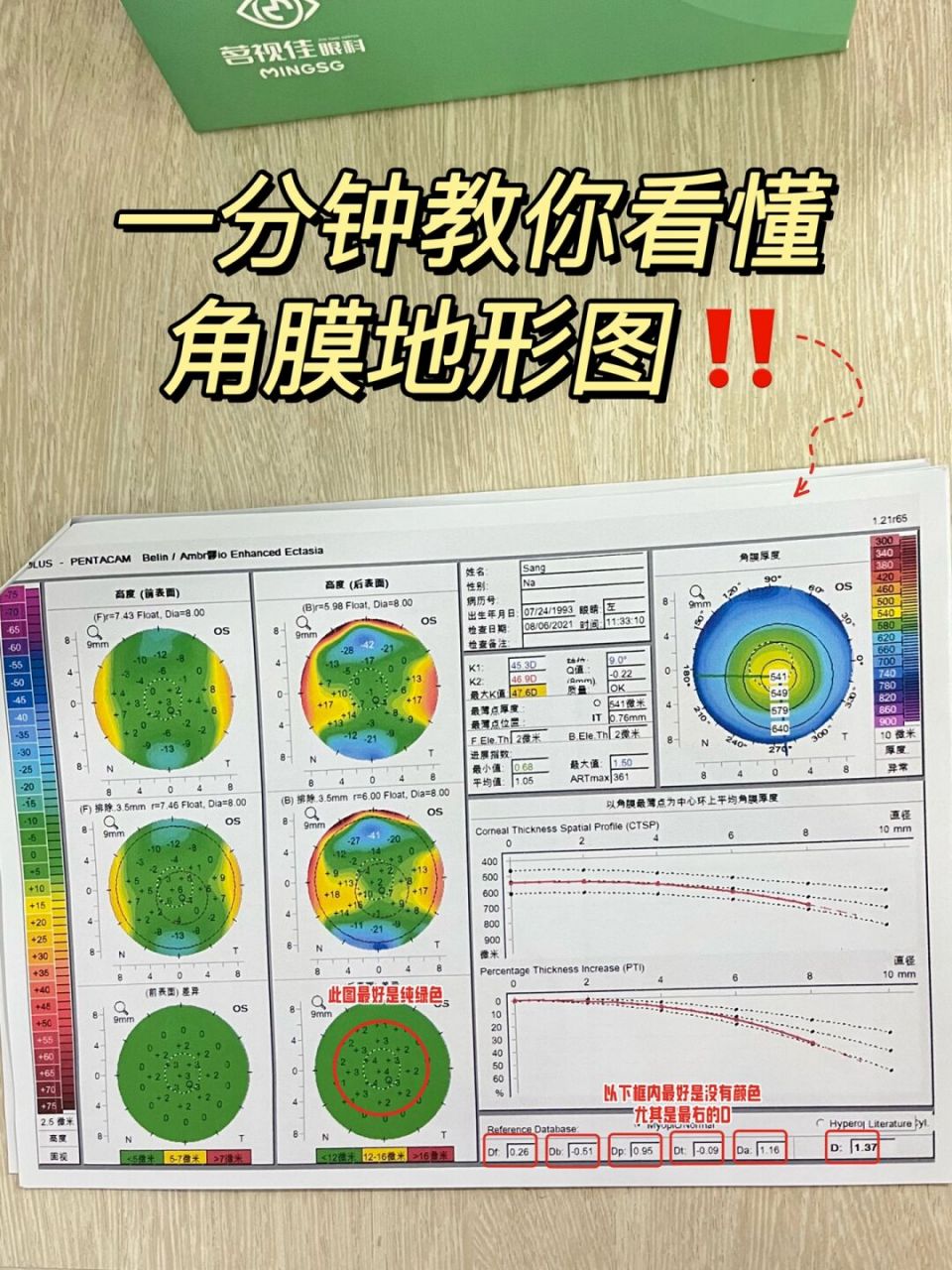 角膜地形图怎么看图片