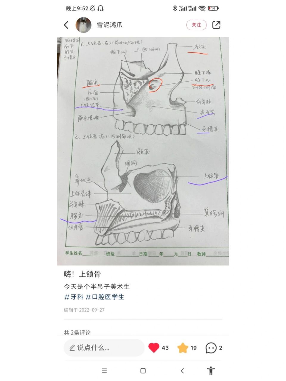 上颌骨解剖 上颌骨位于颜面中部分为一体四突 上颌体,额突,颧突,腭突