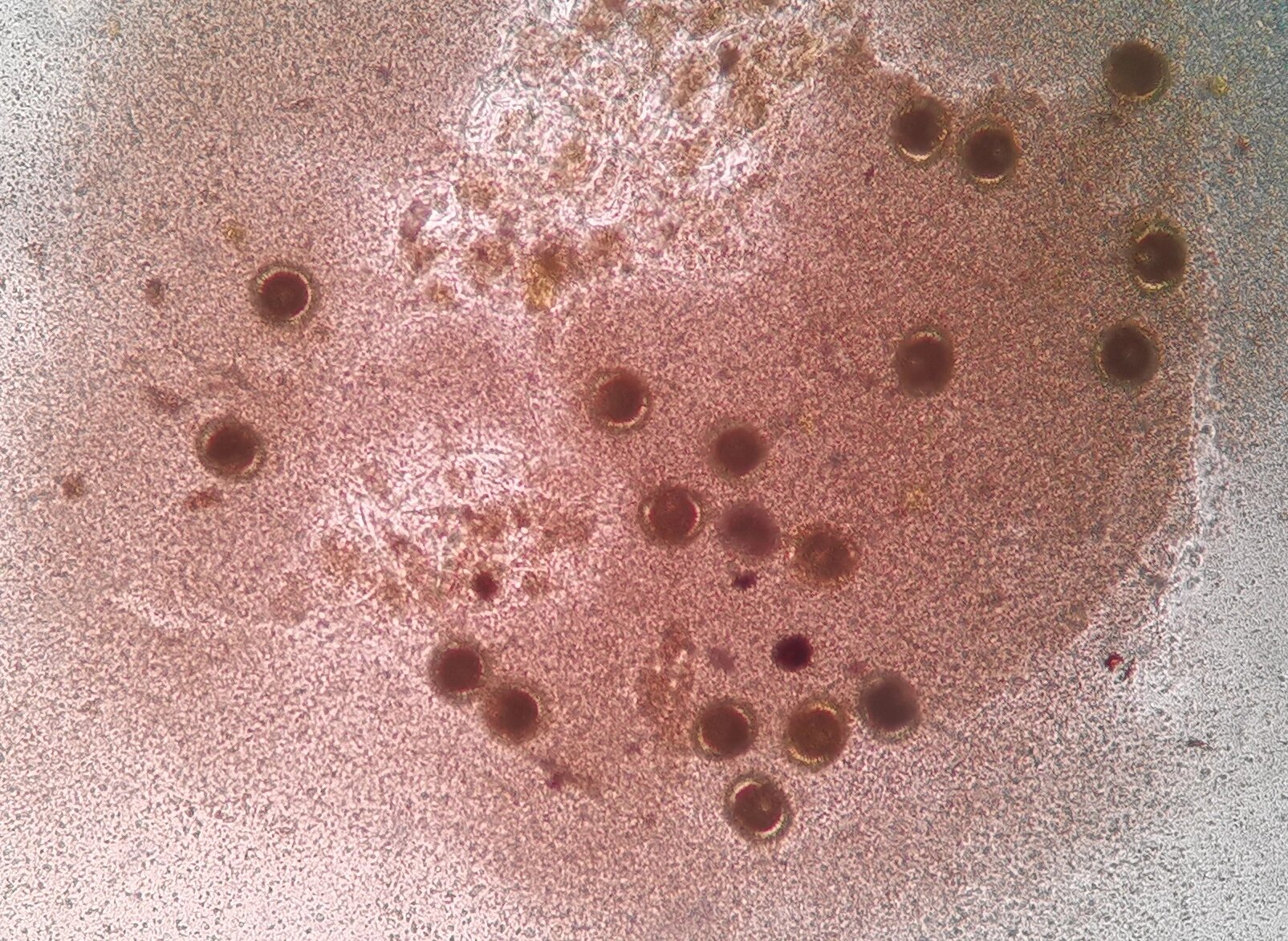 —蛔虫虫卵 1⃣蛔虫虫卵的形态❗️ 蛔虫卵呈