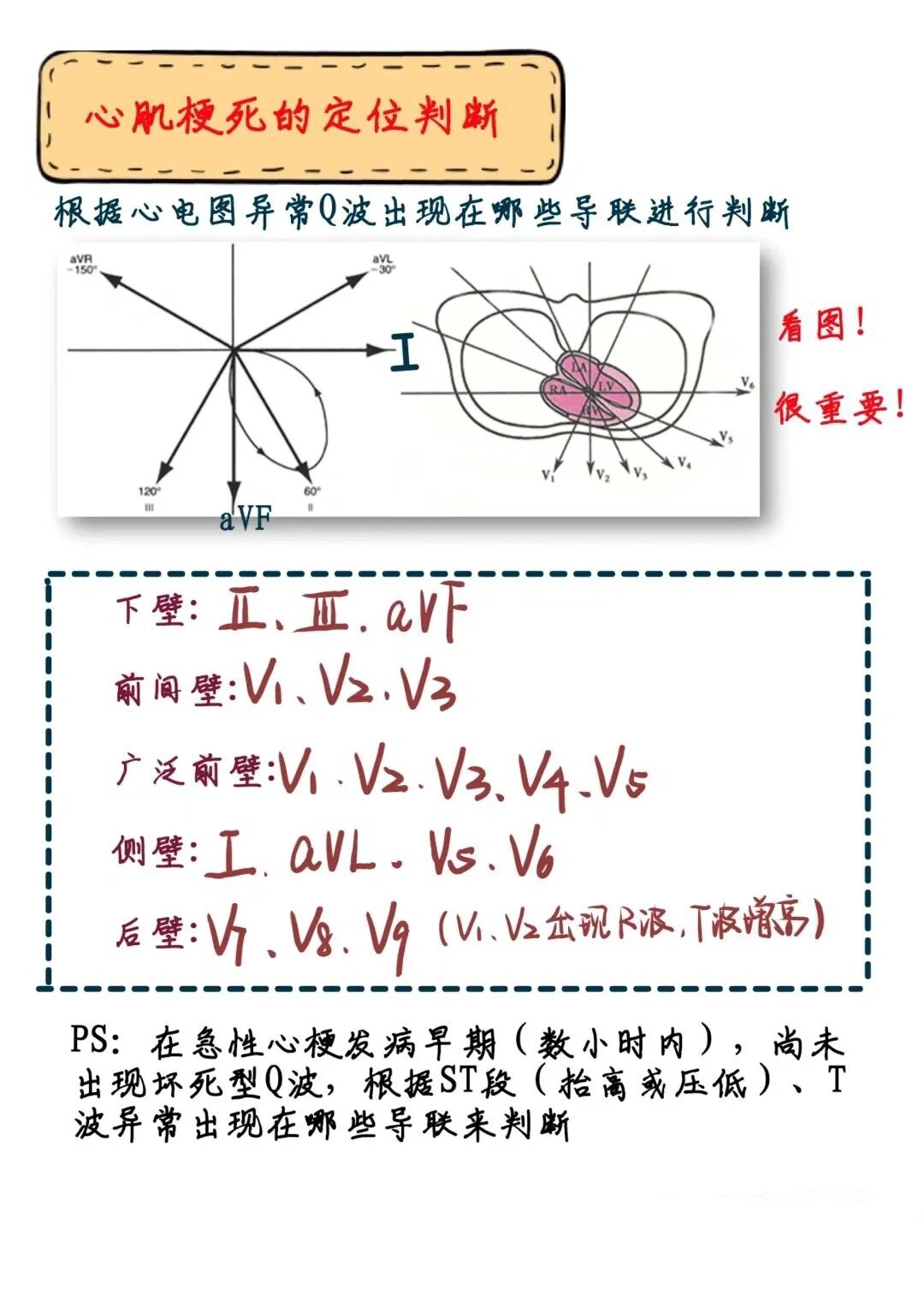 一张图学会心电图