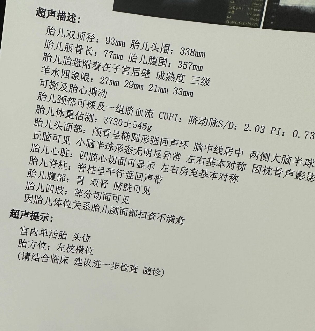 枕横位还顺吗?