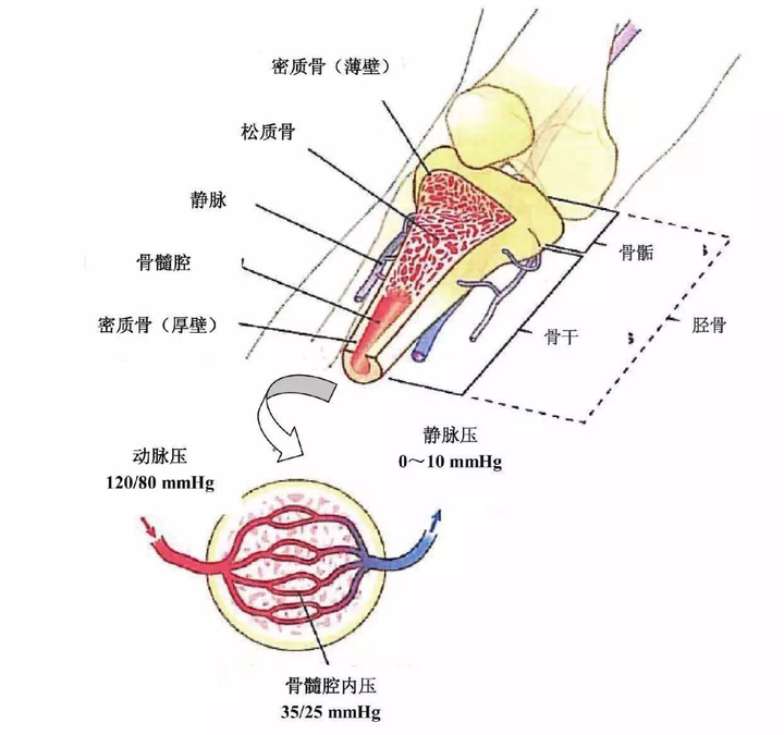 骨髓穿刺位置图解图片