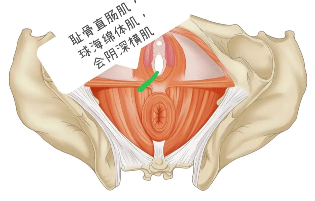 侧切 真实图片