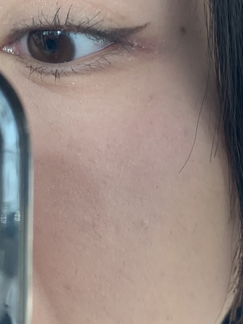 家人眼角起皮是什么情况07