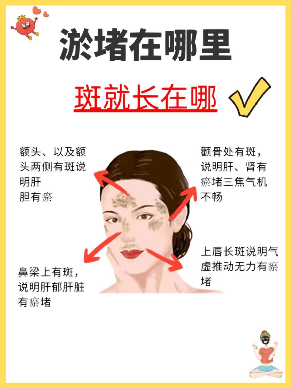 黄褐斑形成的41566个原因6015淡化色斑快收藏 脸上的斑点