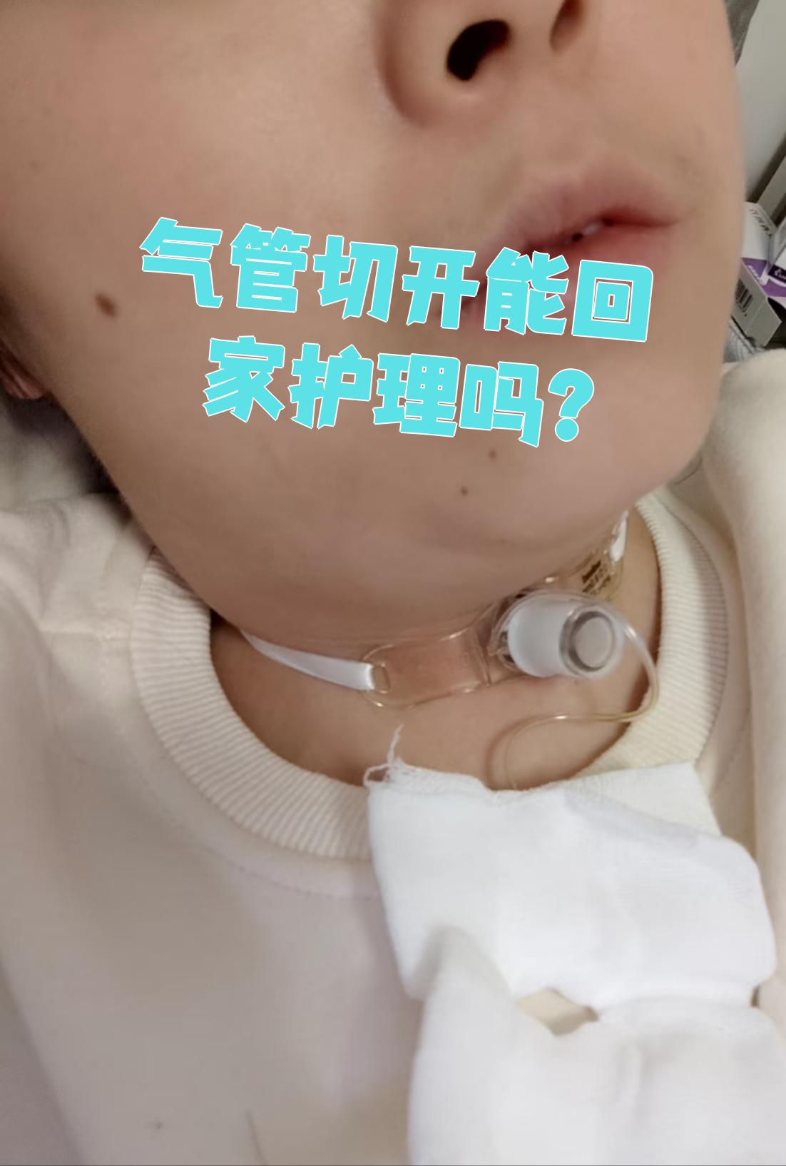 气管切开病人一般不建议回家护理
