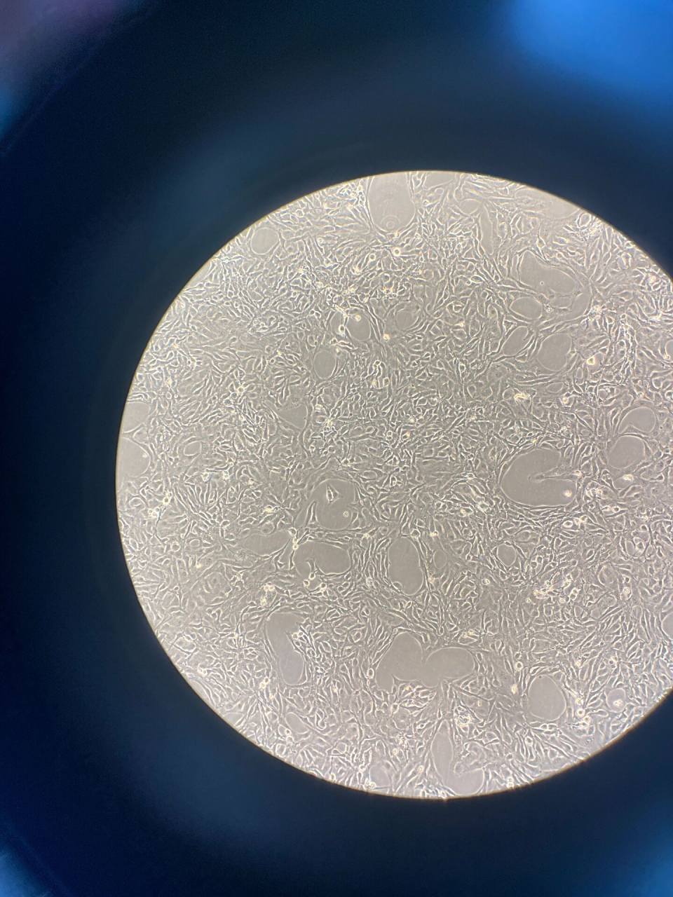 beas-2b细胞这样的形态是好的吗 刚开始养细胞 不知道beas-2b细胞这样