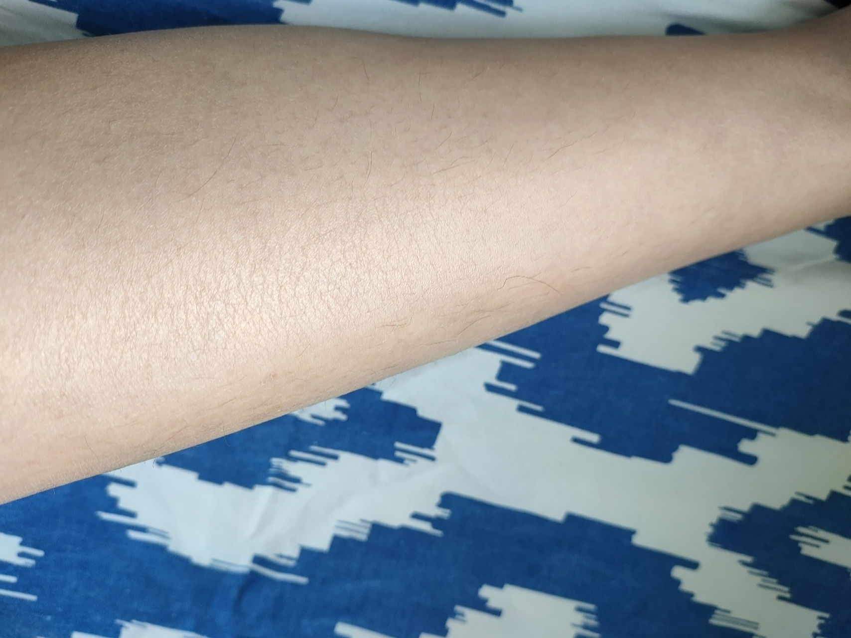 突然长了很长的腿毛是怎么回事 性别:女 腿上一直