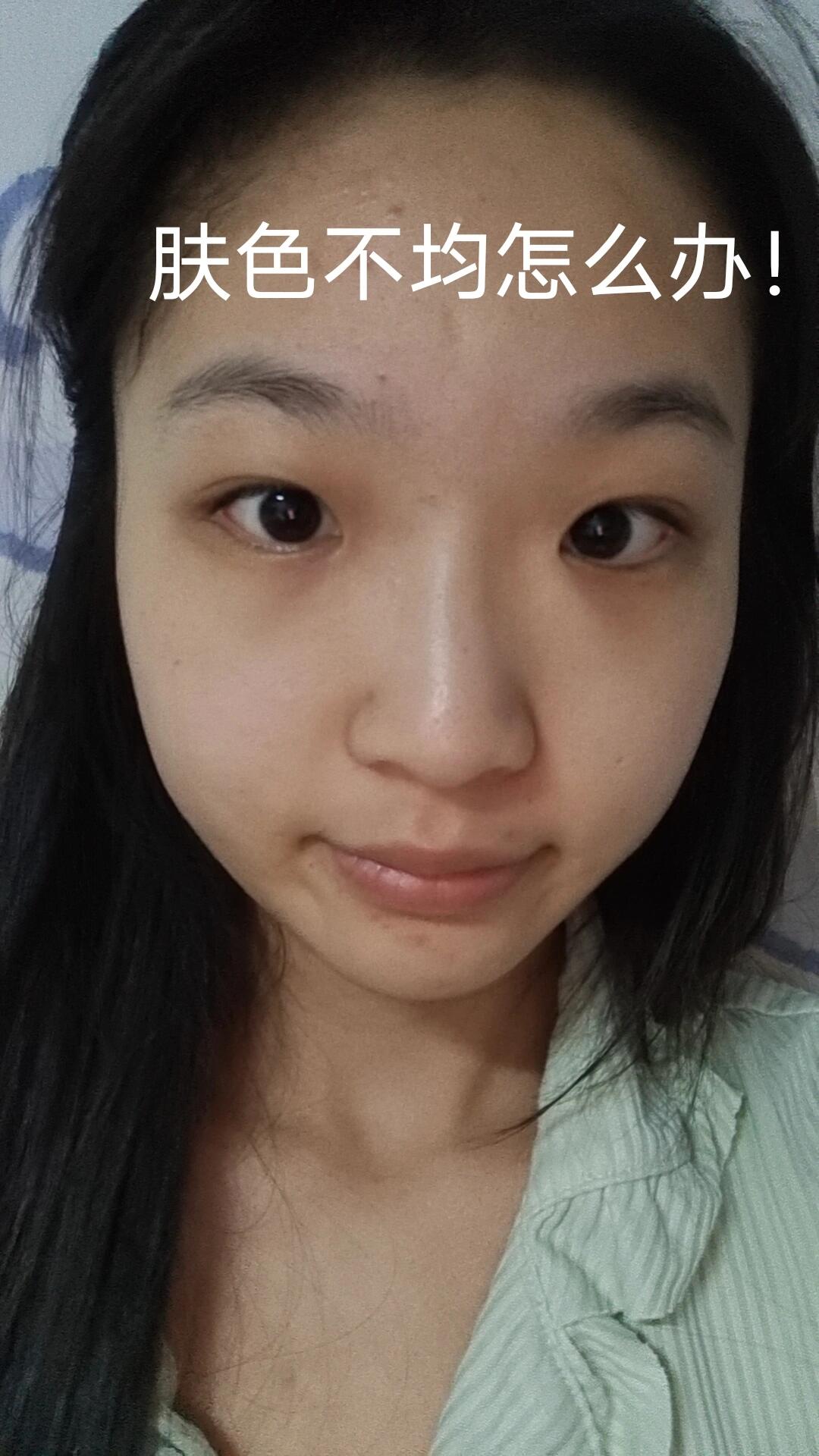 首先肤色不均分为局部肤色不均和全脸肤色不均,局部肤色不均匀主要是