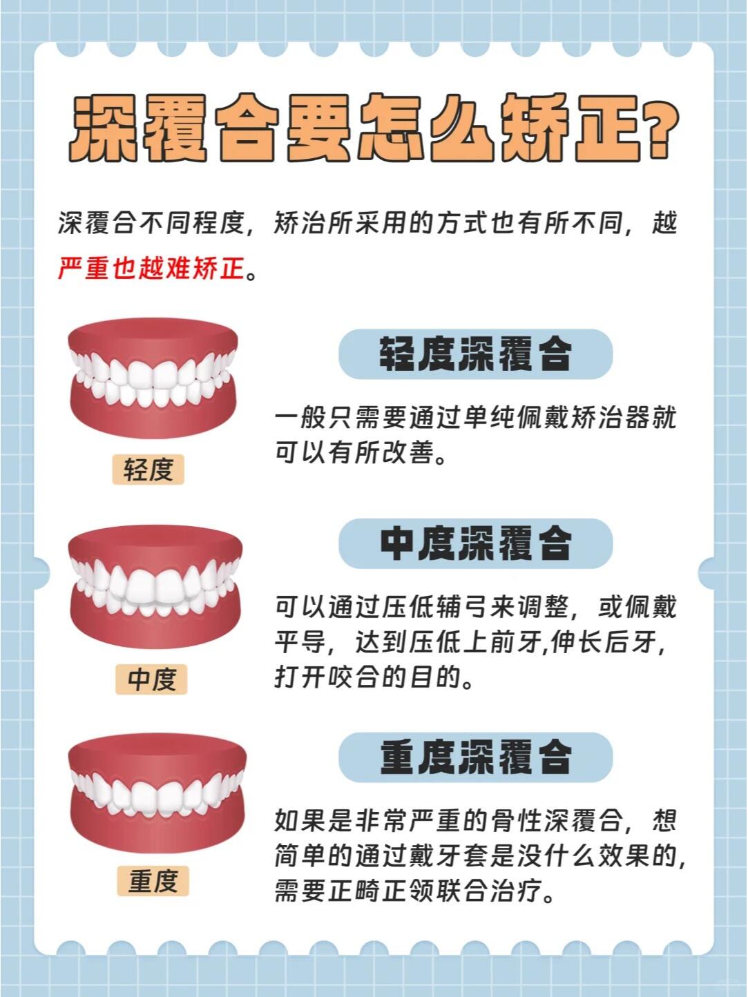 深覆合怎么矫正?看这一篇就够了