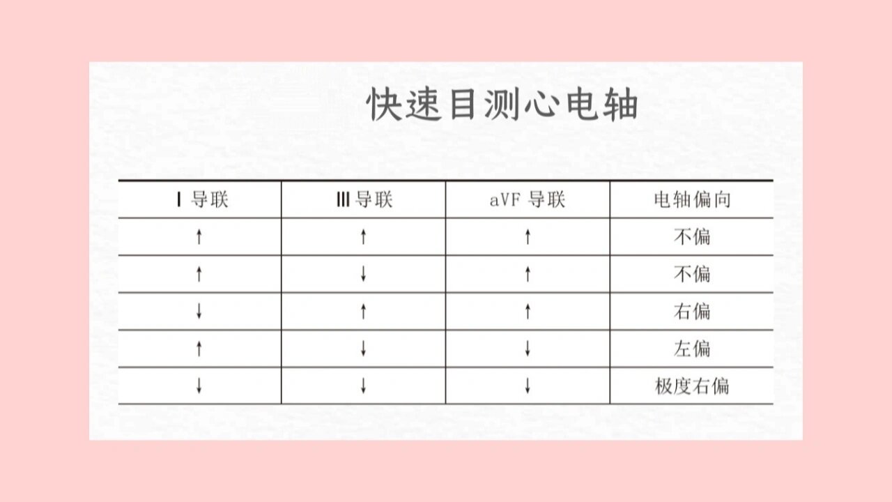 day5:带你认识心电图的电轴