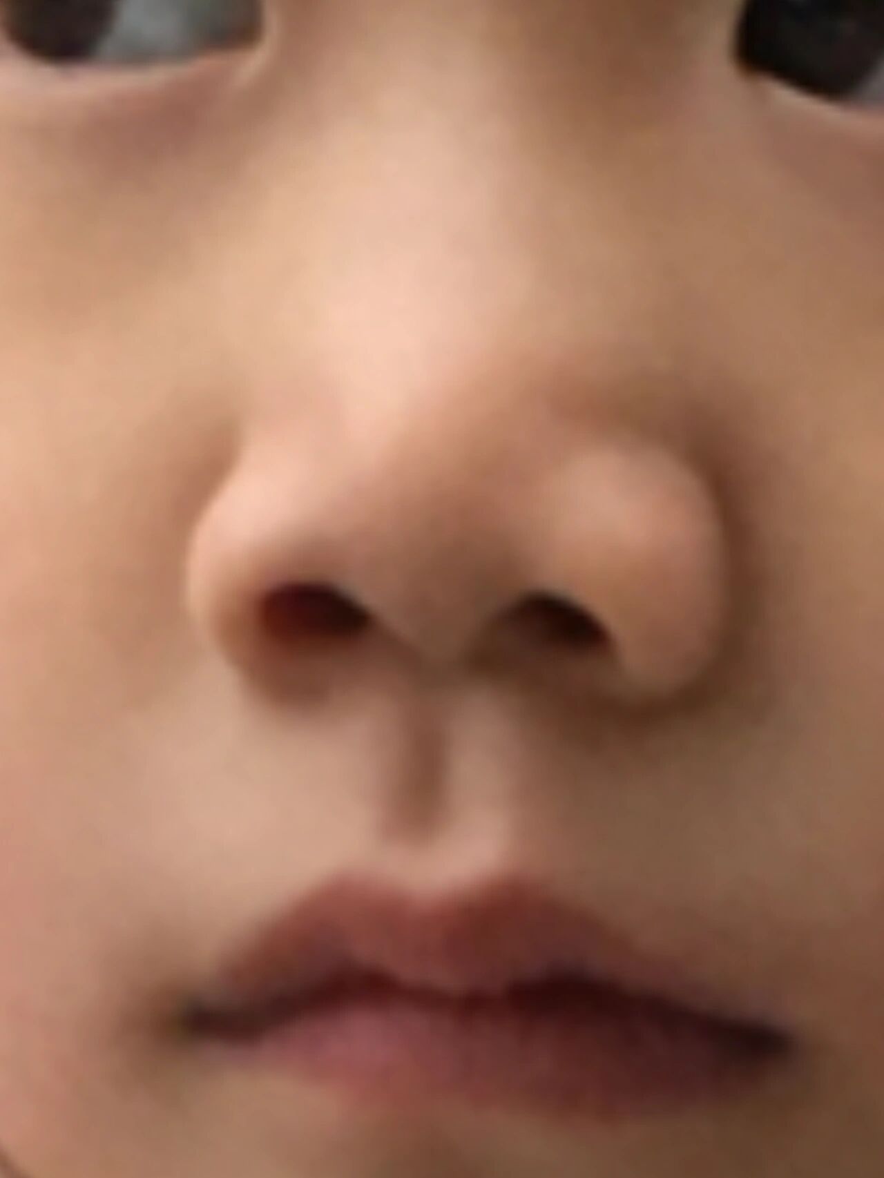 小孩6岁还没有长鼻尖,以后会有吗,急 孩子爸爸鼻子非常立体,孩子生