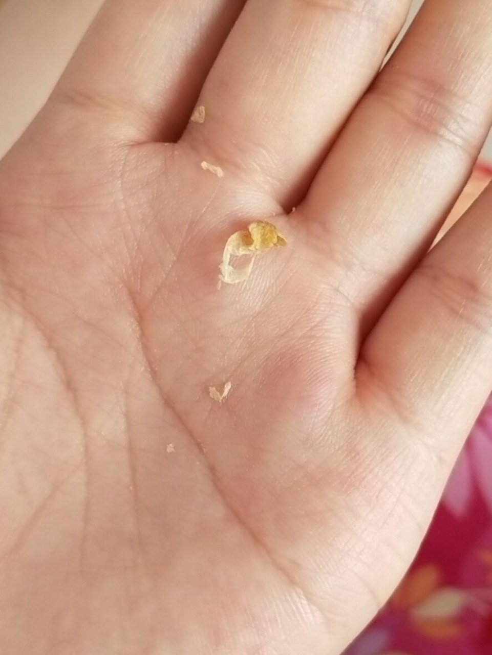 宝宝耳屎能掏吗 用夜光耳勺从一岁半宝宝耳朵里面掏出来一堆耳屎 我的