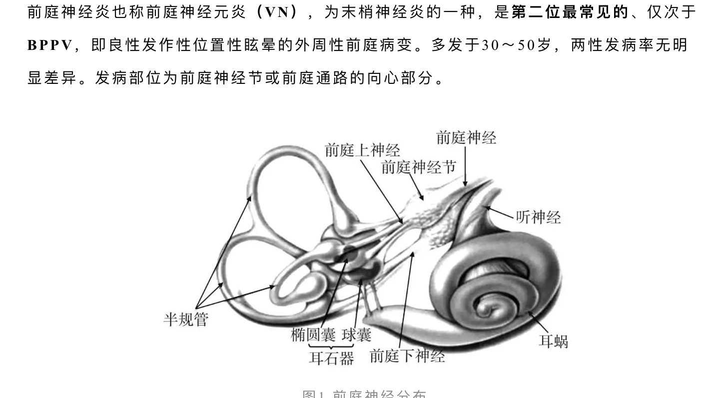 前庭神经 位置图片