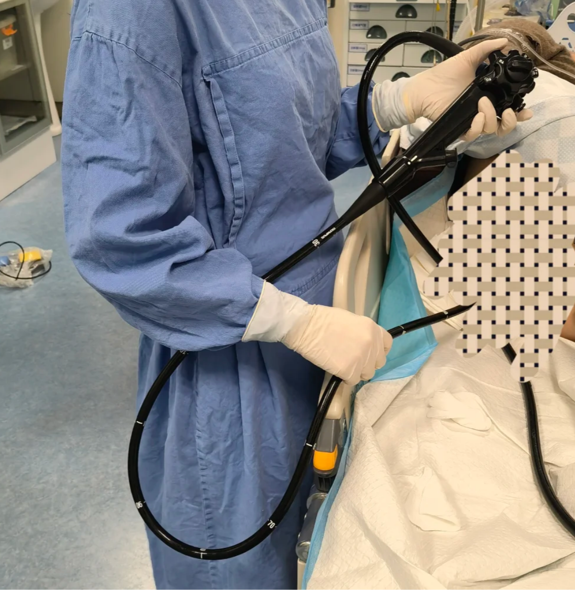 最近老是肚子疼,拉肚子,最常见的原因是慢性结