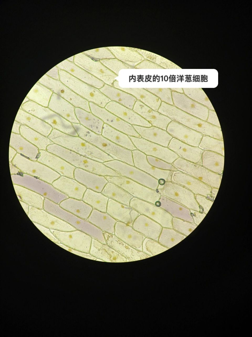 显微镜下的口腔上皮细胞洋葱细胞红细胞