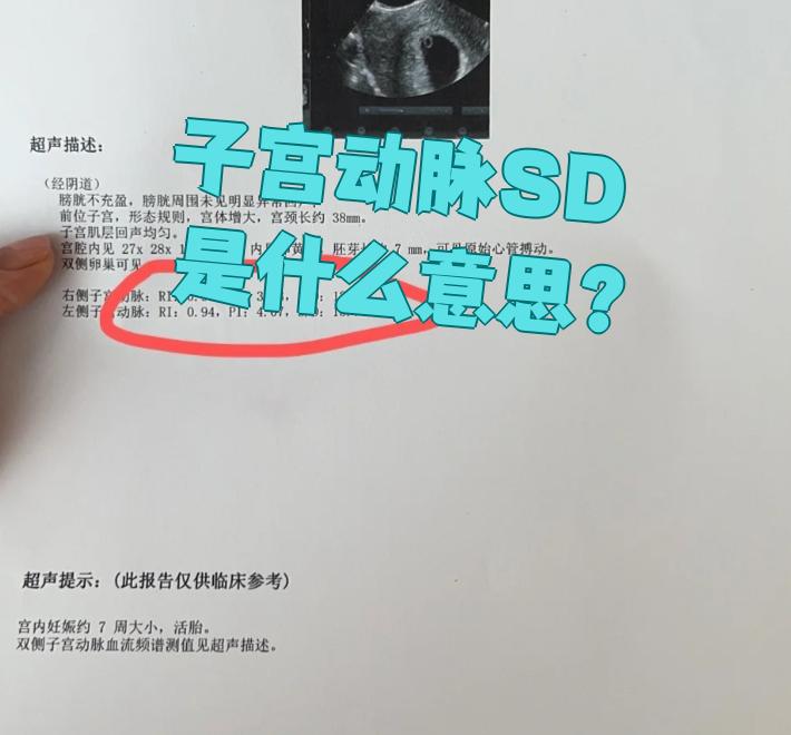 SD是什么意思，sd是什么意思医学