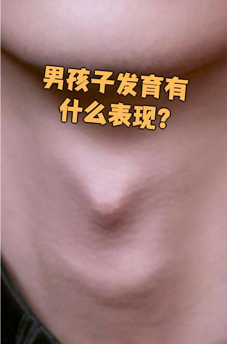 随着发育进展,喉结会逐渐突