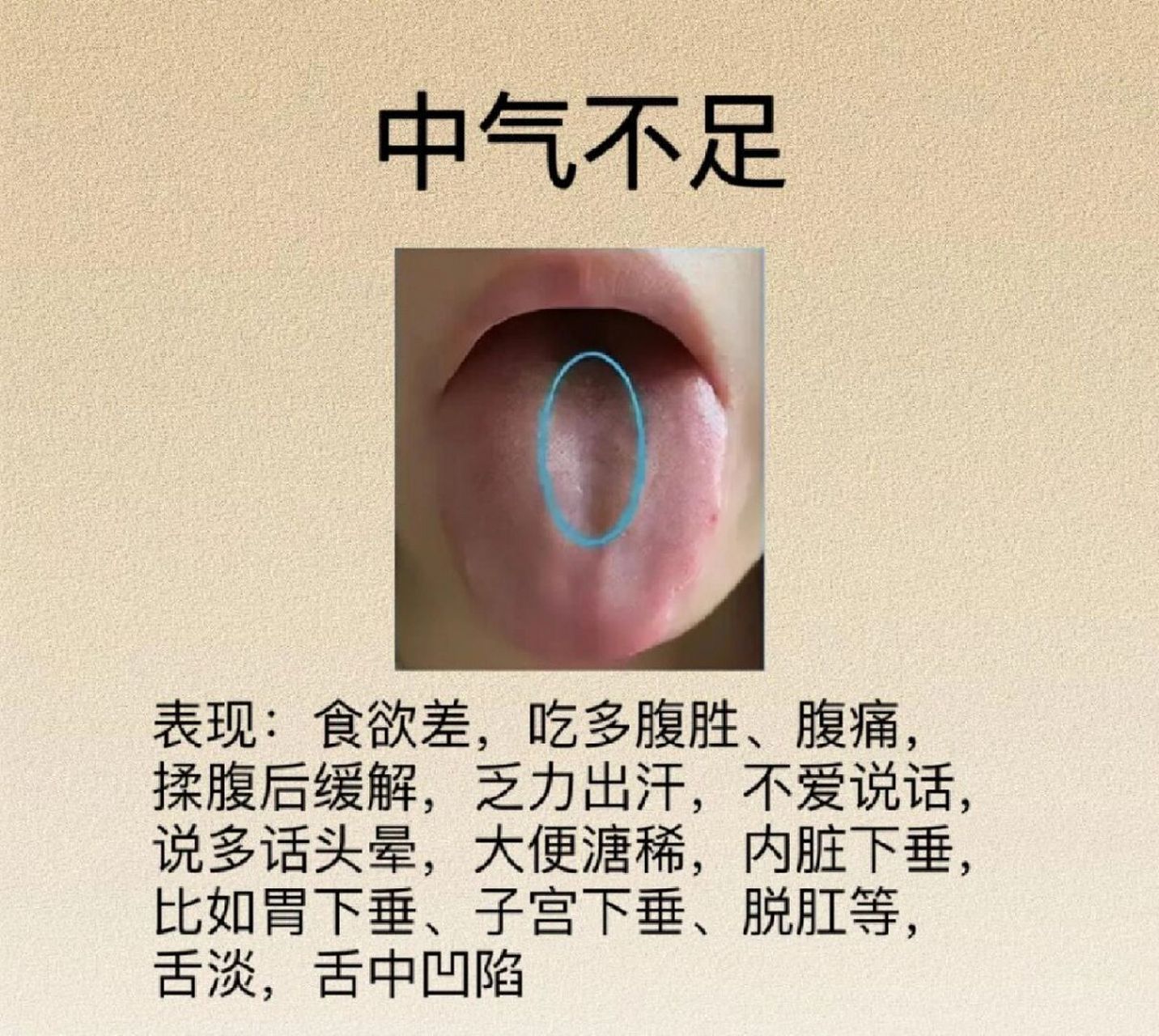 脾虚# #健康知识科普# #知识科普# 健康 #舌诊