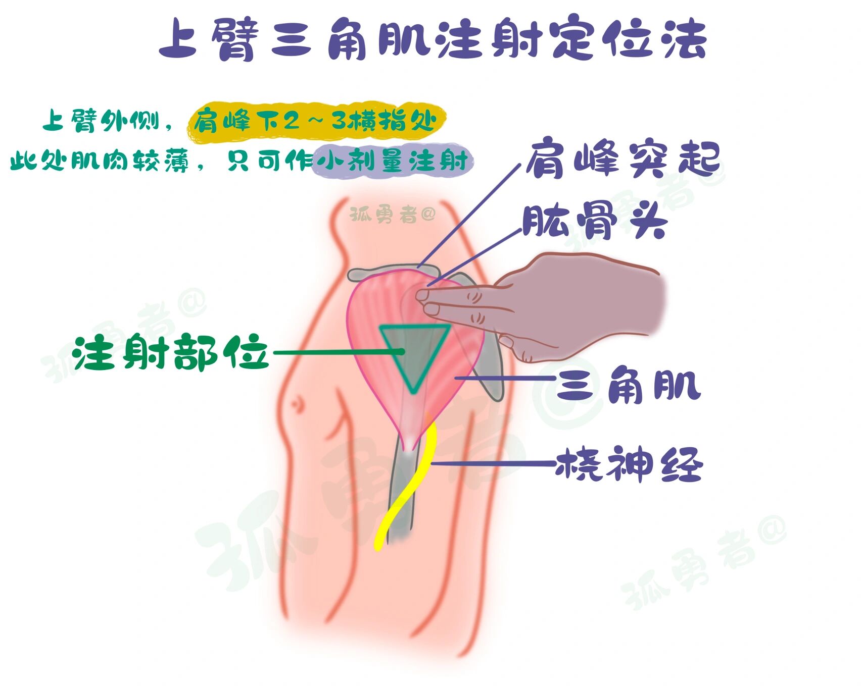 上臂三角肌定位法