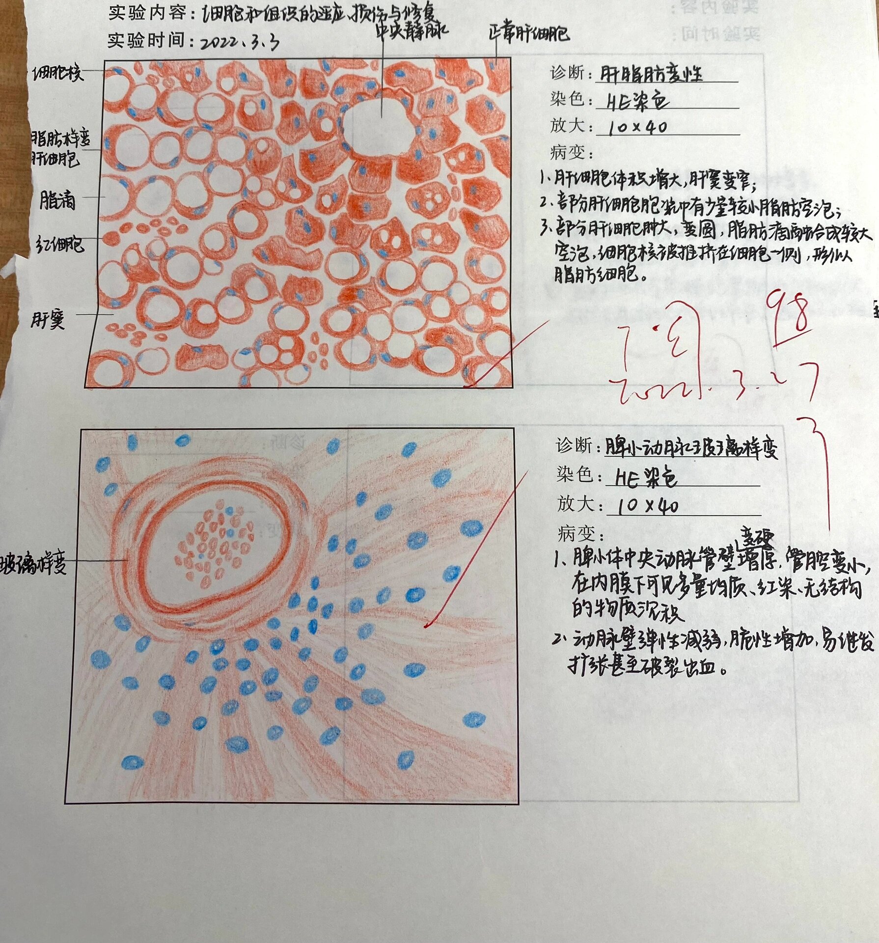 病理学 医学生红蓝铅笔绘图