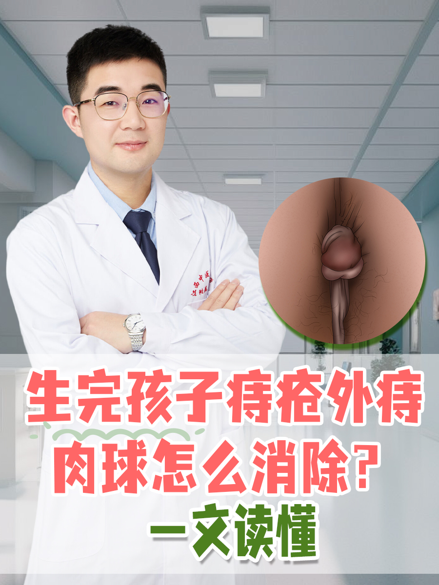 生完孩子痔疮外痔肉球怎么消除?