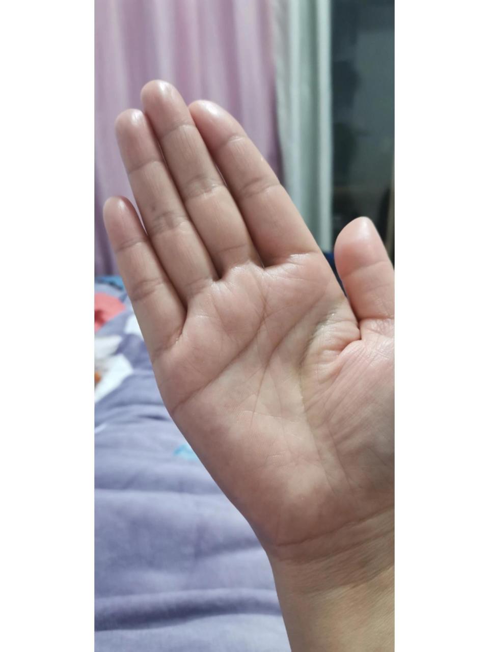 高锰酸钾染色怎么处理 前几分钟还烦躁呀,手指被泡成棕色了,怎么也洗