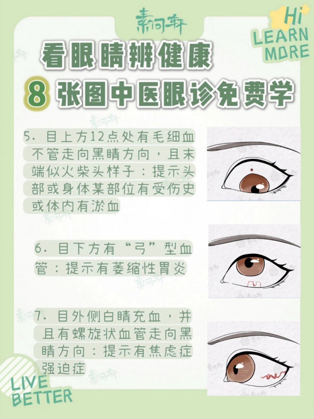 跟中医学眼诊60158张图教你眼睛看健康92 我发现很多宝宝对中yi