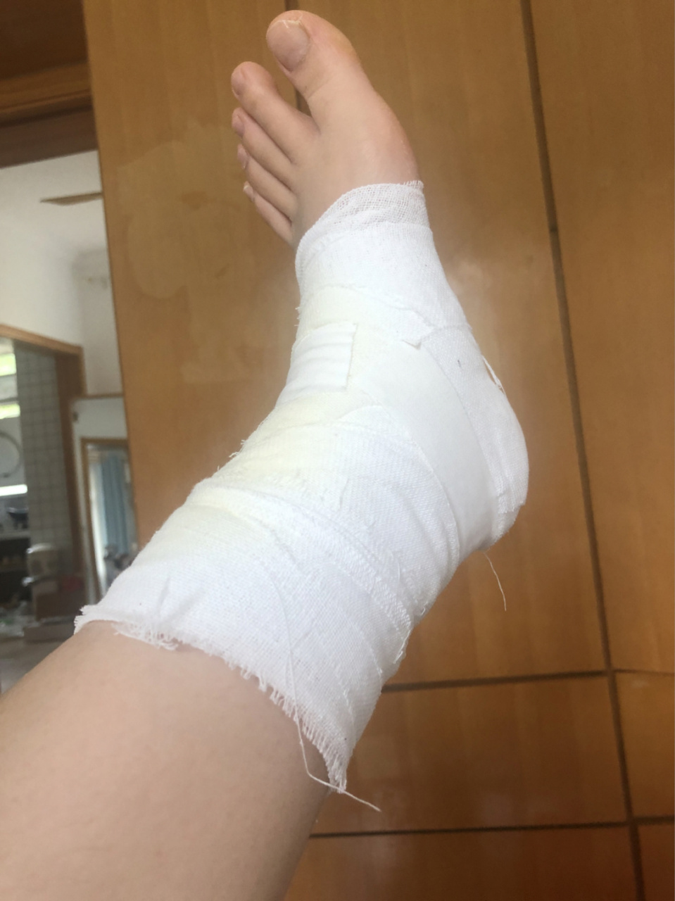 今天是受伤的第25天,接近4周 上午先去中医诊所那换药,补下一周的