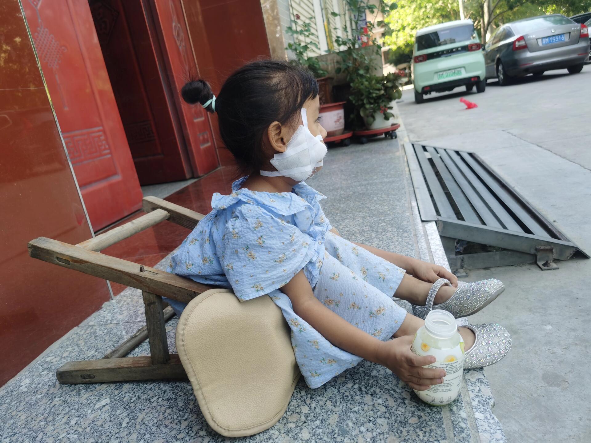 不是特效 是炸腮98 谁敢相信 白天我的宝宝还是前一组照片那么可爱