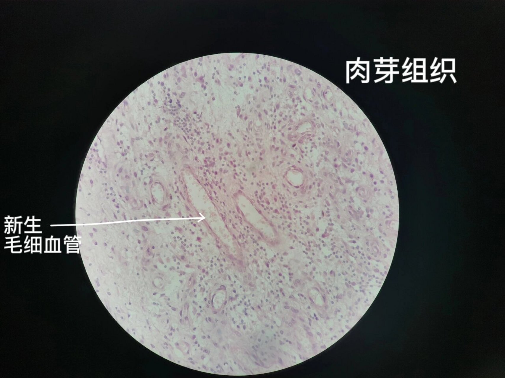 肉芽组织显微镜下图图片