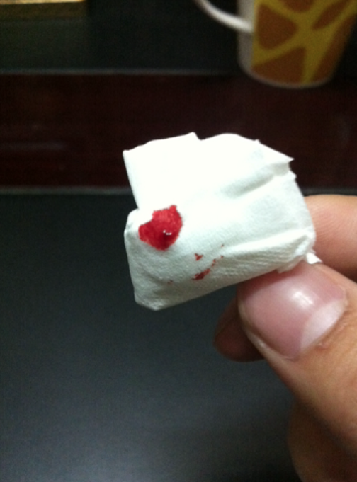 排便时出血并有血块,可能是以下原因引起的,需要根据具体情况处理