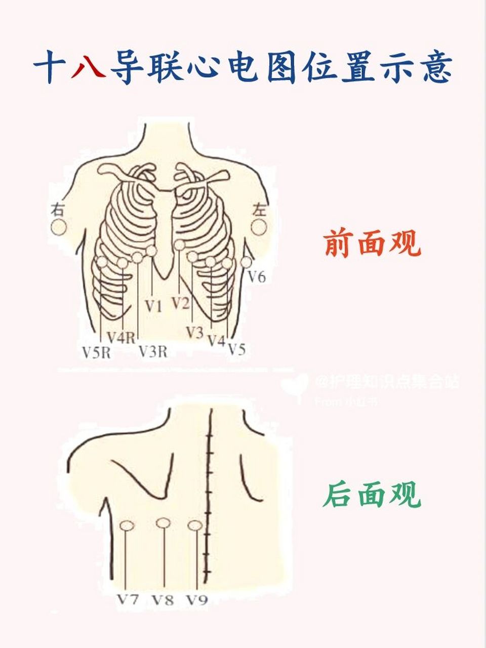 18导联心电图位置图解图片