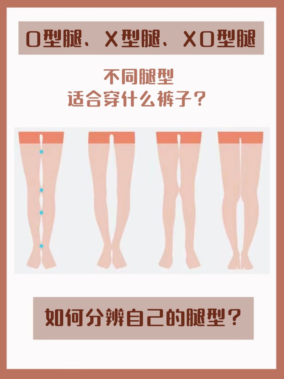 o型腿,x型腿,xo型腿,不同腿型适合什么裤子?
