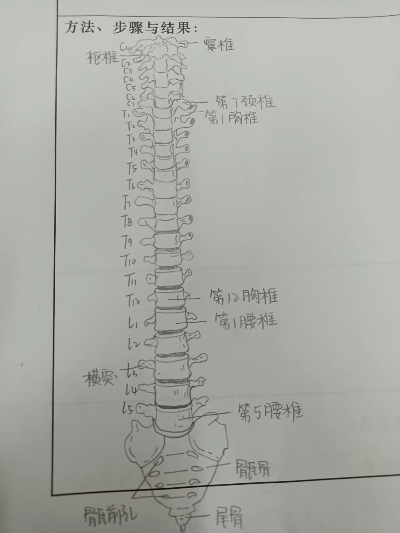 浅浅的画一个脊柱图