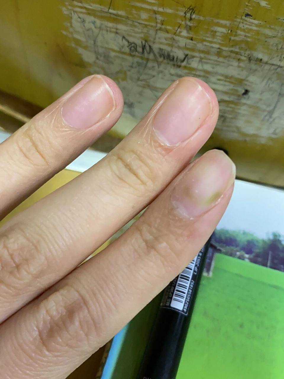 甲片贴太久指甲变绿太吓人了呀!