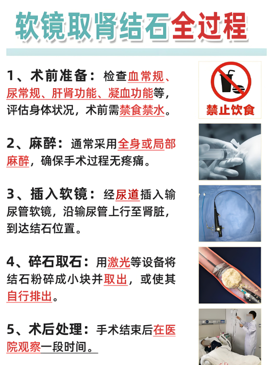 肾结石激光碎石手术是在麻醉状态下做的,所以手术过程中不会疼