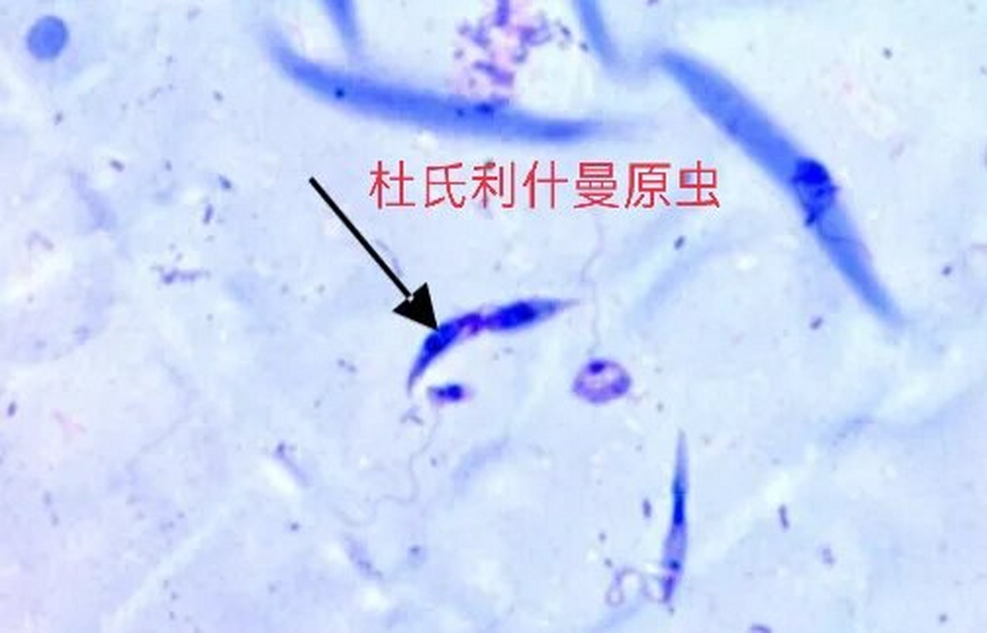 杜氏利什曼原虫利杜体图片