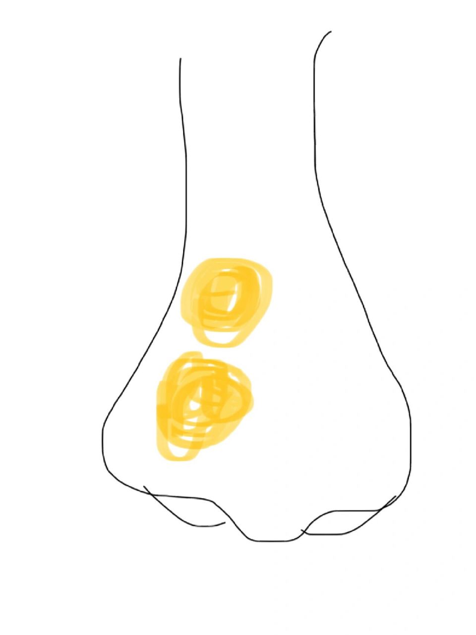 几天前鼻子按着隐隐作痛,没在意.