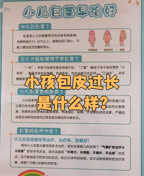 小孩包皮过长是指包皮完全盖住龟头和尿道口,但包皮口比较宽松,用手