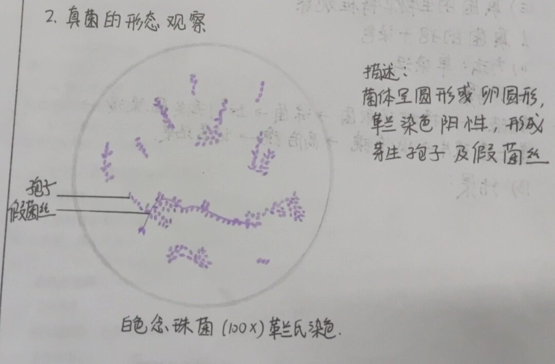 白色念珠菌革兰氏染色手绘
