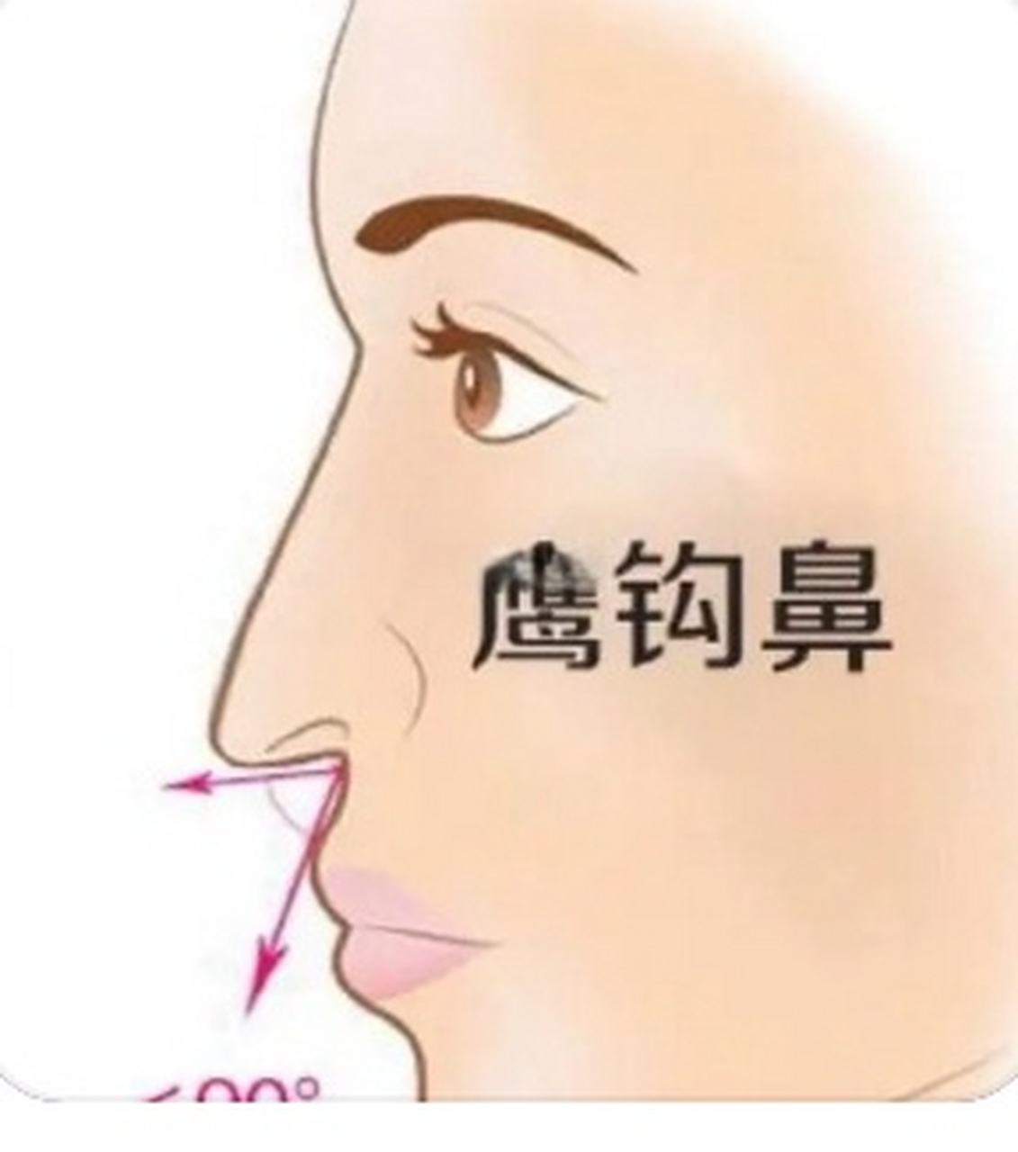 转运[超话]  鼻子不仅影响人的颜值,亦影响人的运势,那鹰钩鼻的面相