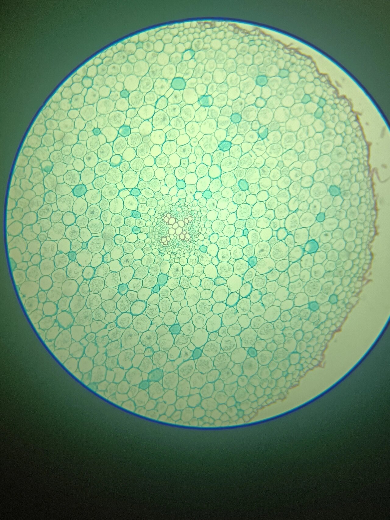 毛茛根横切切片观察