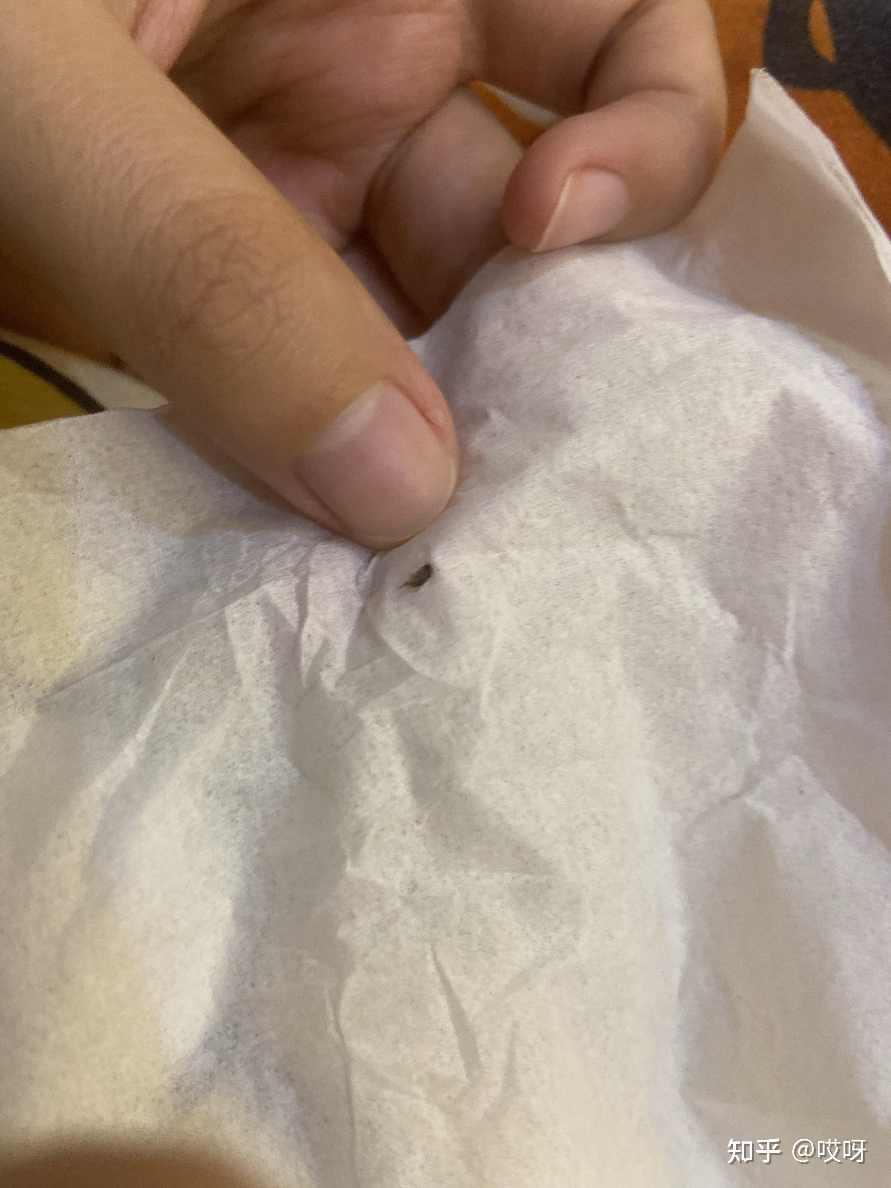 求助家里的这种小飞虫是什么虫咬人吗怎么消灭