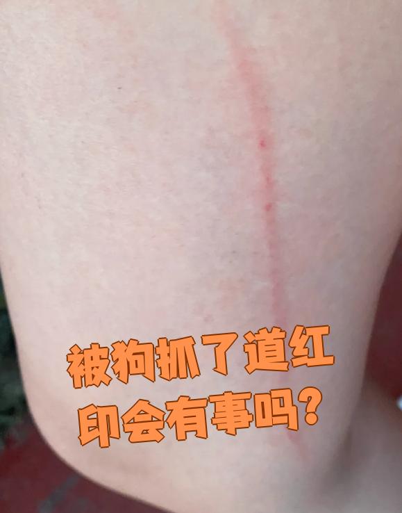 被狗抓出一道红印有没有事,主要看伤口深浅和有没有出血