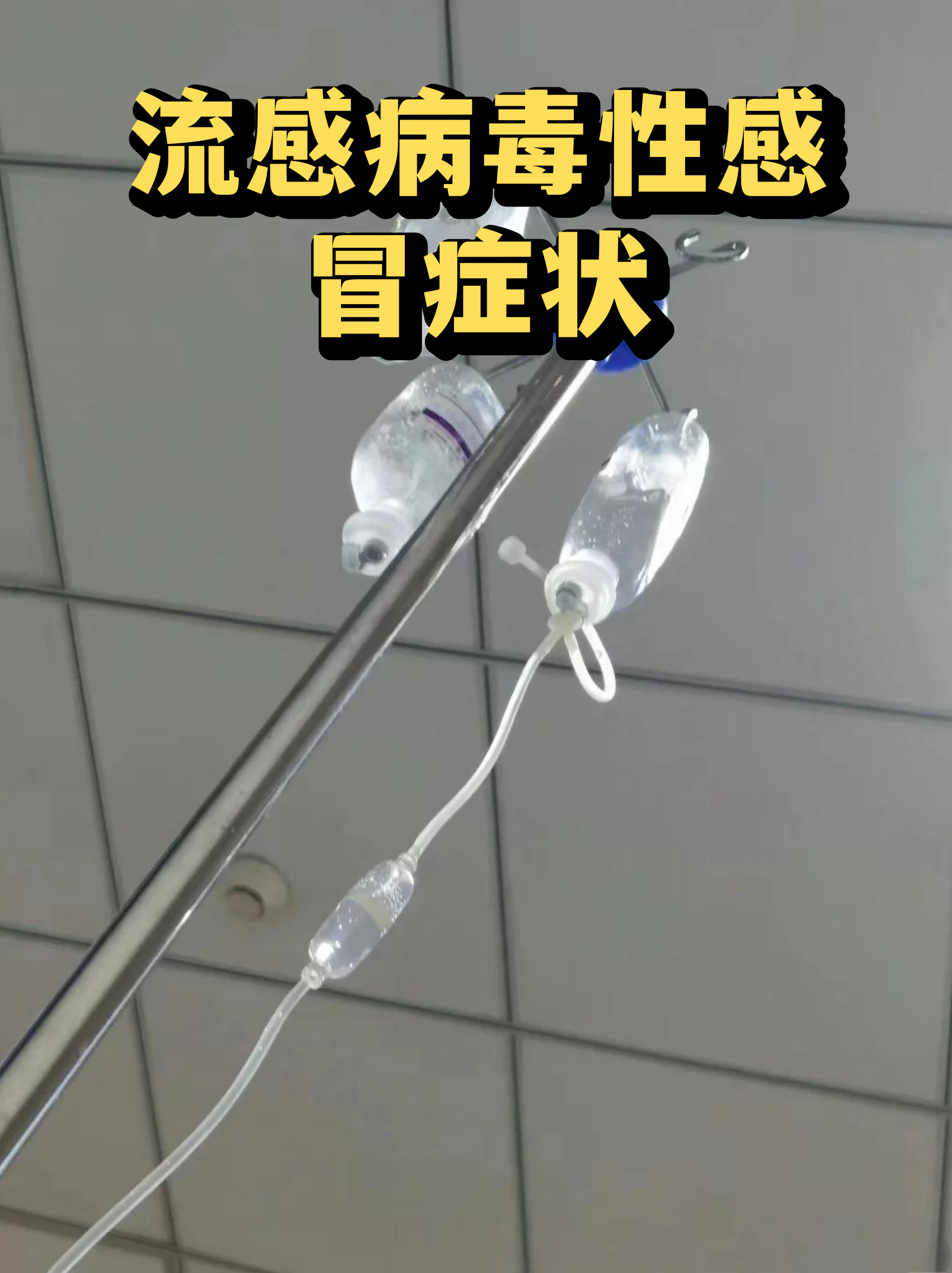  现在感冒是病毒性感冒吗小孩怎么办(现在感冒是病毒性感冒吗小孩怎么办呢)