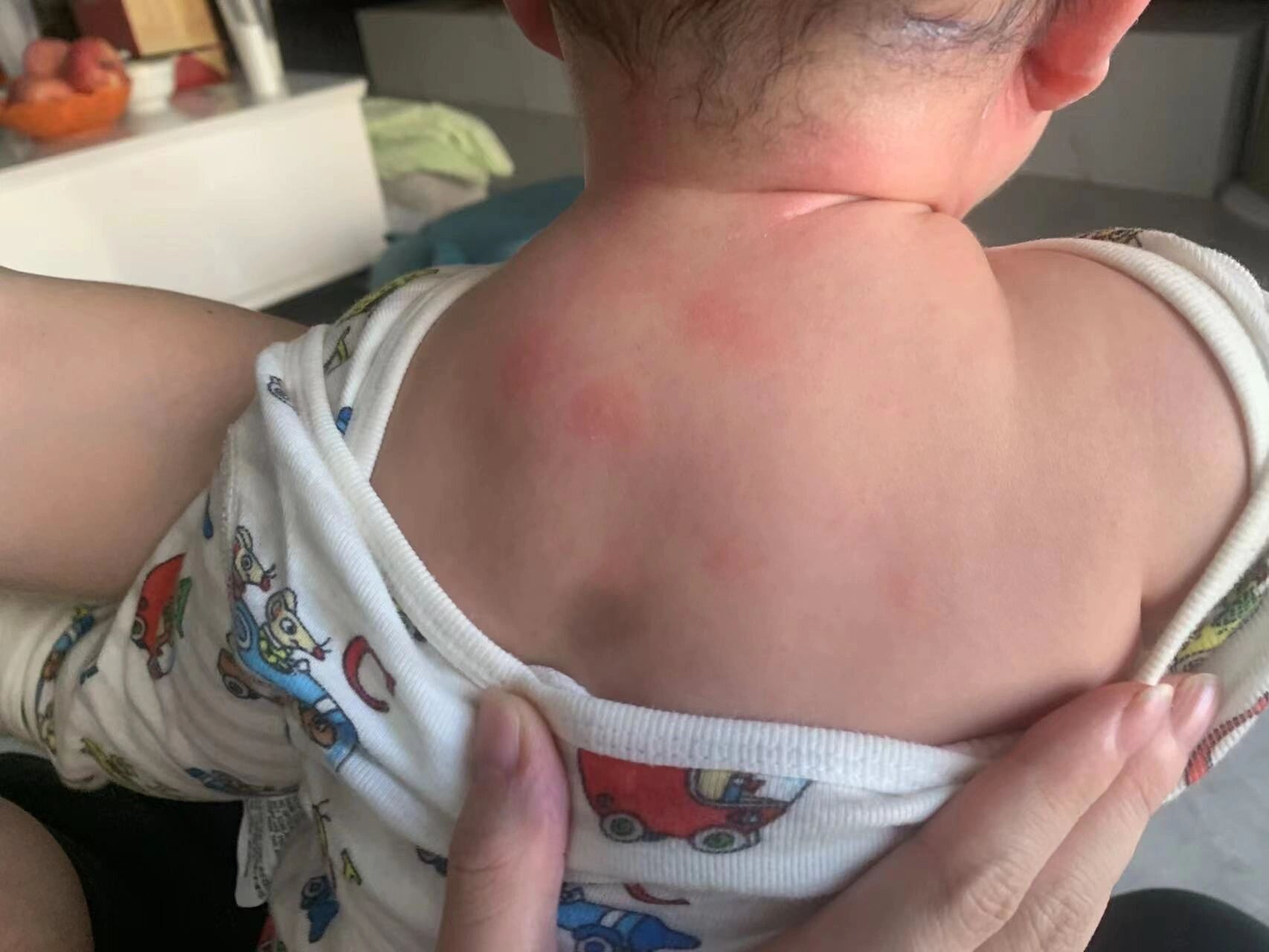 7215避雷:贝亲桃子水过敏 98东旗舰店买的桃子水,就倒出一滴,给