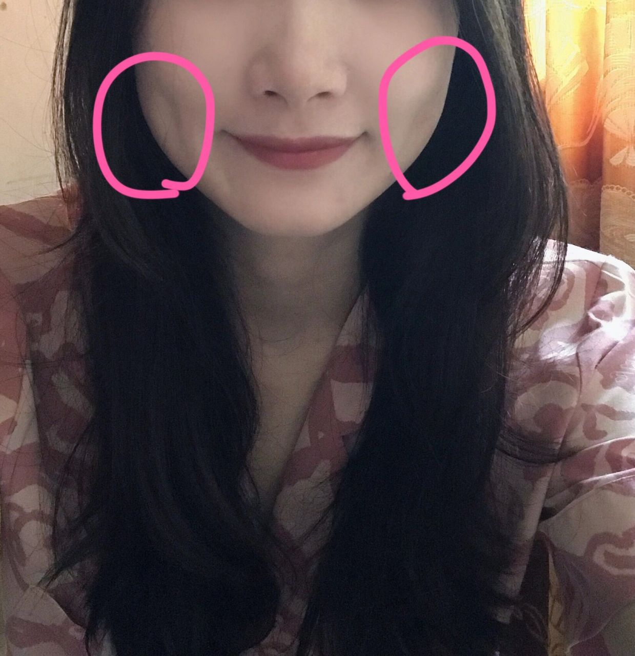 什么是捧场纹? 不知道什么时候,发现自己笑起来脸真大.