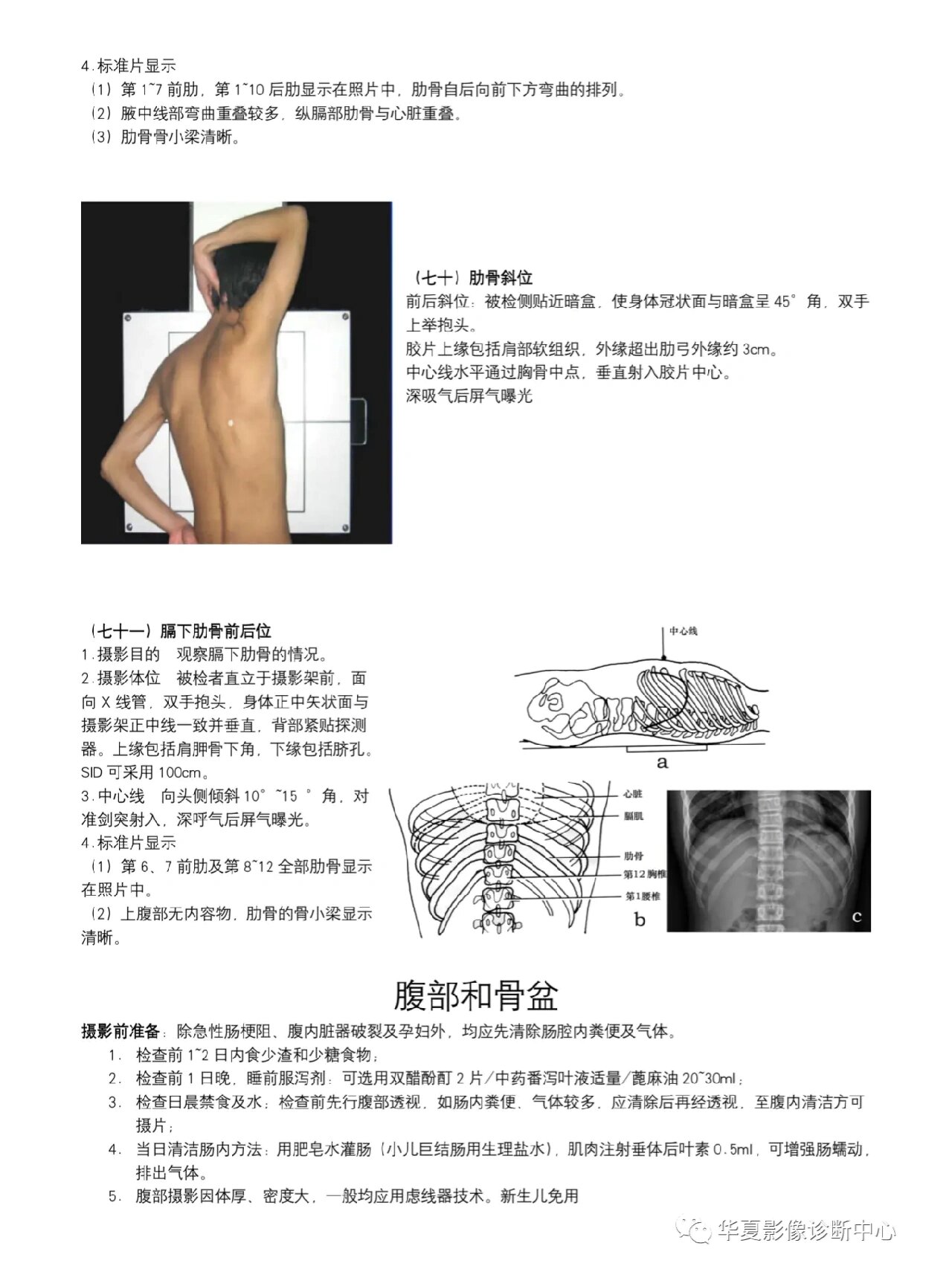 腹部仰卧前后位