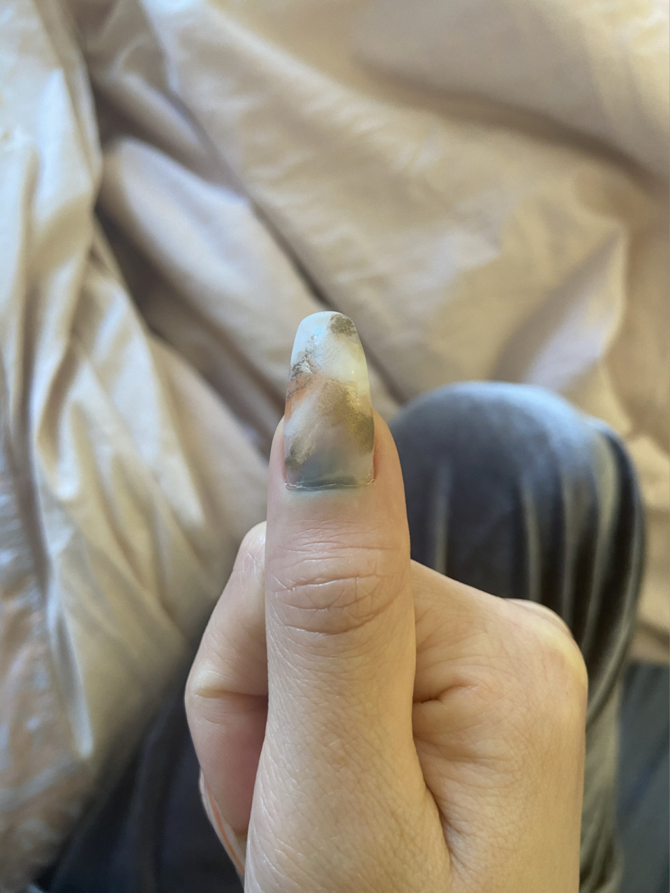 被车门夹到手指 当时真的想哇一声哭出来…… 十指连心 痛得我说不出